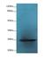 Growth Hormone 2 antibody, LS-C375774, Lifespan Biosciences, Western Blot image 