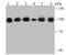 Actinin Alpha 4 antibody, A01975, Boster Biological Technology, Western Blot image 