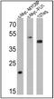 Cellular myelocytomatosis oncogene antibody, PA1-981, Invitrogen Antibodies, Western Blot image 