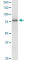 SMAD Specific E3 Ubiquitin Protein Ligase 1 antibody, H00057154-M01, Novus Biologicals, Western Blot image 