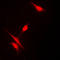 Histone Deacetylase 10 antibody, LS-C353583, Lifespan Biosciences, Immunofluorescence image 