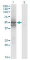 Isocitrate Dehydrogenase (NADP(+)) 2, Mitochondrial antibody, ab55271, Abcam, Western Blot image 