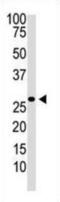 Dickkopf WNT Signaling Pathway Inhibitor 2 antibody, abx028487, Abbexa, Western Blot image 