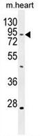 TBC1 Domain Family Member 14 antibody, AP54164PU-N, Origene, Western Blot image 