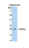 Alpha-2-macroglobulin antibody, LS-C299142, Lifespan Biosciences, Western Blot image 