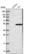 Fumarate Hydratase antibody, NBP1-89815, Novus Biologicals, Western Blot image 