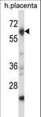 Nuclear Receptor Binding Protein 2 antibody, LS-C164508, Lifespan Biosciences, Western Blot image 