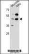 Prolyl 3-Hydroxylase Family Member 4 (Non-Enzymatic) antibody, 56-941, ProSci, Western Blot image 