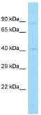 Sulfhydryl oxidase 2 antibody, TA334359, Origene, Western Blot image 