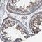 AXL Receptor Tyrosine Kinase antibody, NBP1-83073, Novus Biologicals, Immunohistochemistry frozen image 