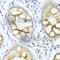 Protein Kinase C Alpha antibody, A0267, ABclonal Technology, Immunohistochemistry paraffin image 