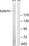 TSC Complex Subunit 2 antibody, TA314644, Origene, Western Blot image 