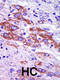 Casein Kinase 1 Delta antibody, 62-884, ProSci, Immunohistochemistry paraffin image 