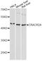 Calcium Release Activated Channel Regulator 2A antibody, A13839, ABclonal Technology, Western Blot image 
