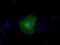 Glucose-6-Phosphate Isomerase antibody, MA5-25101, Invitrogen Antibodies, Immunocytochemistry image 