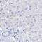 Myozenin 2 antibody, PA5-57390, Invitrogen Antibodies, Immunohistochemistry paraffin image 