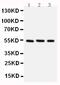 Checkpoint Kinase 1 antibody, PA5-79040, Invitrogen Antibodies, Western Blot image 