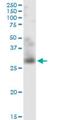 TNF Superfamily Member 12 antibody, H00008742-M01, Novus Biologicals, Western Blot image 