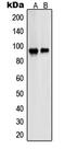 Proteasome 26S Subunit, Non-ATPase 2 antibody, MBS822094, MyBioSource, Western Blot image 