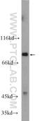 Apurinic/Apyrimidinic Endodeoxyribonuclease 1 antibody, 25133-1-AP, Proteintech Group, Western Blot image 