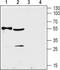 Solute Carrier Family 29 Member 2 antibody, PA5-77545, Invitrogen Antibodies, Western Blot image 