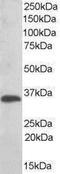 Thioredoxin Related Transmembrane Protein 1 antibody, PA1-33100, Invitrogen Antibodies, Western Blot image 