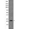 Regulator Of Calcineurin 1 antibody, abx218230, Abbexa, Western Blot image 