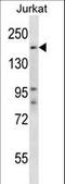 SPT5 Homolog, DSIF Elongation Factor Subunit antibody, LS-C161620, Lifespan Biosciences, Western Blot image 