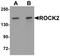 Rho Associated Coiled-Coil Containing Protein Kinase 2 antibody, NBP1-76570, Novus Biologicals, Western Blot image 