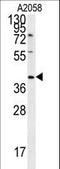 CD99 Molecule Like 2 antibody, LS-C168578, Lifespan Biosciences, Western Blot image 