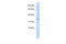 Cyclin Dependent Kinase 5 antibody, 27-214, ProSci, Enzyme Linked Immunosorbent Assay image 