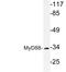 MYD88 Innate Immune Signal Transduction Adaptor antibody, LS-C177581, Lifespan Biosciences, Western Blot image 