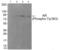 Androgen Receptor antibody, PA5-37480, Invitrogen Antibodies, Western Blot image 