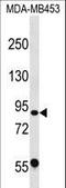 Calpain 13 antibody, LS-C168299, Lifespan Biosciences, Western Blot image 