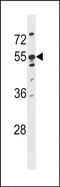 Keratin 86 antibody, PA5-72152, Invitrogen Antibodies, Western Blot image 