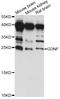 Glial Cell Derived Neurotrophic Factor antibody, LS-C749634, Lifespan Biosciences, Western Blot image 