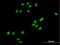 Charged Multivesicular Body Protein 1A antibody, H00005119-B02P, Novus Biologicals, Immunocytochemistry image 