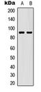 Signal Transducer And Activator Of Transcription 5A antibody, orb315817, Biorbyt, Western Blot image 