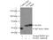 N-Acylsphingosine Amidohydrolase 1 antibody, 11274-1-AP, Proteintech Group, Immunoprecipitation image 