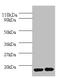 Interleukin 1 Receptor Antagonist antibody, LS-C211407, Lifespan Biosciences, Western Blot image 