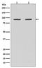 Heat Shock Protein 90 Alpha Family Class B Member 1 antibody, M01692, Boster Biological Technology, Western Blot image 