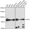 Glutamine-Fructose-6-Phosphate Transaminase 2 antibody, A15374, ABclonal Technology, Western Blot image 