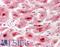 Lon Peptidase 1, Mitochondrial antibody, LS-B10032, Lifespan Biosciences, Immunohistochemistry frozen image 