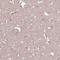 Inactive dipeptidyl peptidase 10 antibody, NBP2-13936, Novus Biologicals, Immunohistochemistry paraffin image 