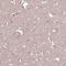 Dipeptidyl Peptidase Like 10 antibody, NBP2-13936, Novus Biologicals, Immunohistochemistry paraffin image 