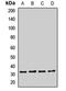 Exosome Component 2 antibody, LS-C668738, Lifespan Biosciences, Western Blot image 