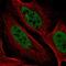 YdjC Chitooligosaccharide Deacetylase Homolog antibody, NBP2-57586, Novus Biologicals, Immunofluorescence image 