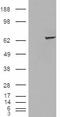 Insulin Like Growth Factor 2 MRNA Binding Protein 2 antibody, EB08289, Everest Biotech, Western Blot image 