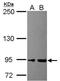 BAF Chromatin Remodeling Complex Subunit BCL11A antibody, PA5-30636, Invitrogen Antibodies, Western Blot image 