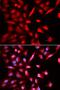 Proteasome 26S Subunit, ATPase 3 antibody, LS-C748398, Lifespan Biosciences, Immunofluorescence image 